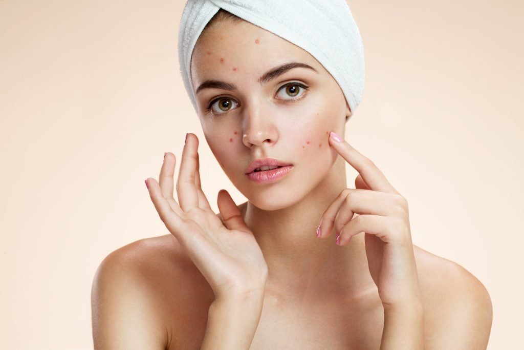 Transform Your Skin with Our Proven Anti-Acne Routine - DermoHelp Skin Care Products - Shop Now